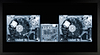 Decks (Framed)
