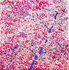 Cherry Blossoms